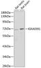 Protein Only RNase P Catalytic Subunit antibody, GTX66424, GeneTex, Western Blot image 