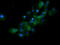 RAB21, Member RAS Oncogene Family antibody, M05683-2, Boster Biological Technology, Immunofluorescence image 