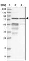 Kazrin antibody, NBP1-92038, Novus Biologicals, Western Blot image 