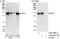 Cohesin subunit SA-2 antibody, A302-580A, Bethyl Labs, Immunoprecipitation image 