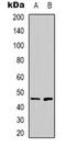 Zinc Finger Protein 785 antibody, orb318950, Biorbyt, Western Blot image 