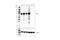 Bruton Tyrosine Kinase antibody, 56044S, Cell Signaling Technology, Western Blot image 