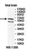 Cdc42 Guanine Nucleotide Exchange Factor 9 antibody, orb78381, Biorbyt, Western Blot image 