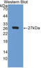 Clusterin antibody, LS-C314236, Lifespan Biosciences, Western Blot image 