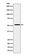 Fatty acid desaturase 1 antibody, M02535, Boster Biological Technology, Western Blot image 