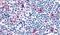 C-C Motif Chemokine Receptor 8 antibody, PA5-33403, Invitrogen Antibodies, Immunohistochemistry frozen image 
