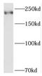 Structural Maintenance Of Chromosomes Flexible Hinge Domain Containing 1 antibody, FNab08021, FineTest, Western Blot image 