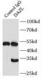 Deleted in azoospermia-like antibody, FNab02252, FineTest, Immunoprecipitation image 