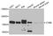 Cytochrome B-245 Beta Chain antibody, TA327116, Origene, Western Blot image 