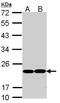 Glutathione Peroxidase 1 antibody, PA5-30593, Invitrogen Antibodies, Western Blot image 