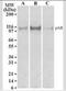 Androgen Receptor antibody, NB100-56603, Novus Biologicals, Western Blot image 