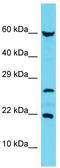 Uncharacterized protein C17orf102 antibody, TA334909, Origene, Western Blot image 