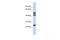 Zinc Finger Protein 200 antibody, A16239, Boster Biological Technology, Western Blot image 