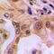 p65 antibody, LS-C354093, Lifespan Biosciences, Immunohistochemistry paraffin image 