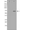 Killer cell immunoglobulin-like receptor 3DL1 antibody, orb228640, Biorbyt, Western Blot image 