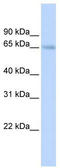 Solute carrier family 22 member 6 antibody, TA346108, Origene, Western Blot image 