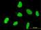 Homeobox protein OTX1 antibody, LS-C197828, Lifespan Biosciences, Immunofluorescence image 