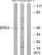 Dopamine Receptor D4 antibody, abx015231, Abbexa, Western Blot image 