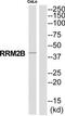 Ribonucleoside-diphosphate reductase subunit M2 B antibody, TA313405, Origene, Western Blot image 