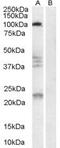 Reticulon 4 Receptor antibody, PA5-18380, Invitrogen Antibodies, Western Blot image 