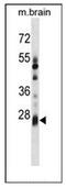 Potassium Channel Tetramerization Domain Containing 6 antibody, AP52324PU-N, Origene, Western Blot image 