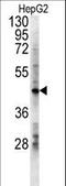 Lactate Dehydrogenase D antibody, LS-C165734, Lifespan Biosciences, Western Blot image 