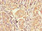 Cyclin Dependent Kinase Inhibitor 2B antibody, A62250-100, Epigentek, Immunohistochemistry paraffin image 