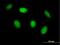 Homeodomain Interacting Protein Kinase 4 antibody, H00147746-B01P, Novus Biologicals, Immunofluorescence image 
