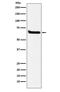 Klotho antibody, M02616-1, Boster Biological Technology, Western Blot image 