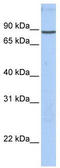 Gelsolin antibody, TA336242, Origene, Western Blot image 