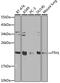 Ferritin Heavy Chain 1 antibody, 14-022, ProSci, Western Blot image 