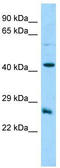 Dynactin Associated Protein antibody, TA331592, Origene, Western Blot image 