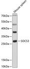 Suppressor of cytokine signaling 3 antibody, A00274-1, Boster Biological Technology, Western Blot image 
