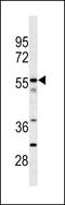 Carboxypeptidase N subunit 2 antibody, GTX81514, GeneTex, Western Blot image 