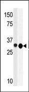 RIO Kinase 2 antibody, AP13533PU-N, Origene, Western Blot image 