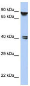 Zinc Finger Protein 429 antibody, TA342107, Origene, Western Blot image 