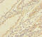 Thioredoxin Like 1 antibody, A54982-100, Epigentek, Immunohistochemistry paraffin image 