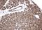 Keratin 8 antibody, LS-C796663, Lifespan Biosciences, Immunohistochemistry paraffin image 