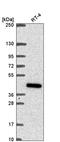 Coenzyme Q2, Polyprenyltransferase antibody, HPA056599, Atlas Antibodies, Western Blot image 