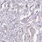 Leucine Rich Repeat Containing 9 antibody, HPA041381, Atlas Antibodies, Immunohistochemistry paraffin image 