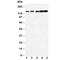 Neurotrophic Receptor Tyrosine Kinase 1 antibody, R30381, NSJ Bioreagents, Western Blot image 
