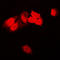 Protein Tyrosine Kinase 2 antibody, LS-C352764, Lifespan Biosciences, Immunofluorescence image 