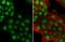 p53 antibody, NB200-104, Novus Biologicals, Immunocytochemistry image 