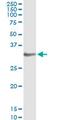 Homeobox protein Hox-A1 antibody, MA5-19110, Invitrogen Antibodies, Immunoprecipitation image 