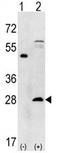 Proteasome Subunit Alpha 5 antibody, AP11427PU-N, Origene, Western Blot image 