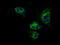 ATP Synthase F1 Subunit Beta antibody, TA500837, Origene, Immunofluorescence image 