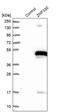 Zinc finger protein 330 antibody, PA5-53367, Invitrogen Antibodies, Western Blot image 