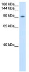 DEAD-Box Helicase 54 antibody, TA341622, Origene, Western Blot image 