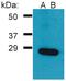 Growth Factor Receptor Bound Protein 2 antibody, GTX00529, GeneTex, Western Blot image 