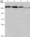 RAD54 Like 2 antibody, PA5-50258, Invitrogen Antibodies, Western Blot image 
